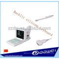 Full-digital portable Medical Equipment/ Ultrasonic Diagnostic Apparatus